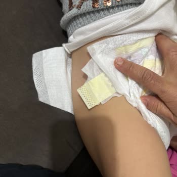 Prima Bebek Bezi Cırtları Kopuyor