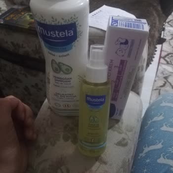 Mustela Ürünlerine Şikayet Var