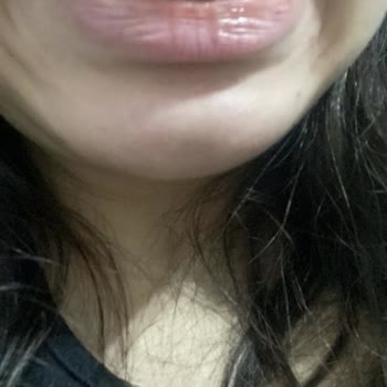 Egemen Esen Diş Kliniği Ortodonti Tedavisinde Yaşanan Sorunlar