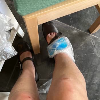 Prev Markasının Ayakkabı Kalitesizliği Ve Dayanıksızlığı