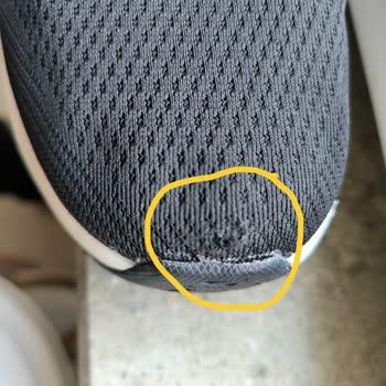 Skechers Ayakkabı İncelemeden Kaynaklanan Ağır Deforme Olması!