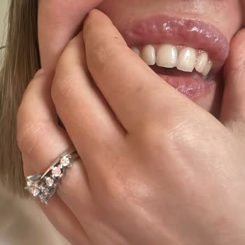 Medicine Hospital Hastane Dermatoloji Bölümünde Yaşanan Sorunlu Estetik İşlem