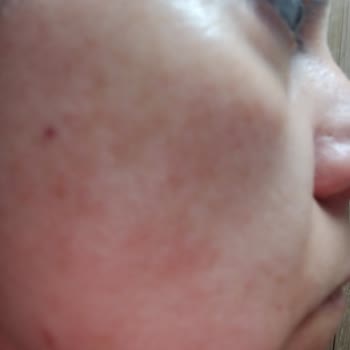 Yves Rocher Dan Aldığım Ürünler Cildimi Mahvetti