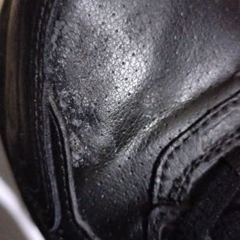 Skechers Spor Ayakkabı Soyulma