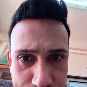 Estetik Clinic Cilt Onarım Adı Altında Güzelim Cildimi Enkaza Dönüştürdüler!