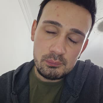 Estetik Clinic Cilt Onarım Adı Altında Güzelim Cildimi Enkaza Dönüştürdüler!