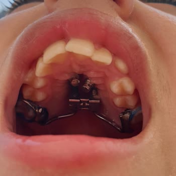 İstanbul Aydın Üniversitesi İstanbul Aydin Üniversitesi Dis Egitim Fakultesi