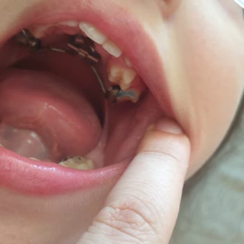 İstanbul Aydın Üniversitesi İstanbul Aydin Üniversitesi Dis Egitim Fakultesi