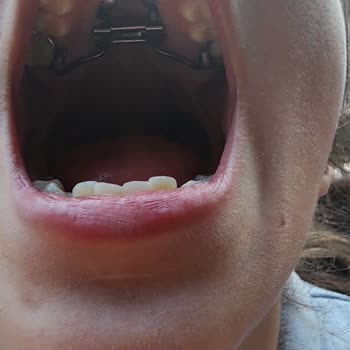 İstanbul Aydın Üniversitesi İstanbul Aydin Üniversitesi Dis Egitim Fakultesi