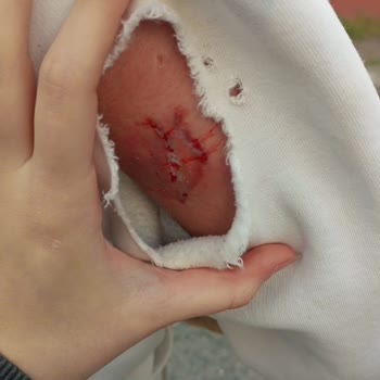İBB - İstanbul Büyükşehir Belediyesi Öncelik Verilirse Çok Mutlu Olurum Buralarda Her Sokaktalar