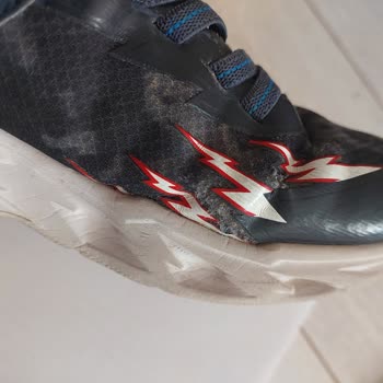 Boyner'den Aldığım Skechers Ayakkabı Dağıldı, Kimse Arkasında Durmuyor