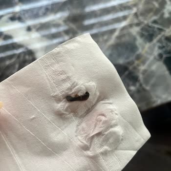 Torku Labne Peynirinden Çıkan Bir Cisim