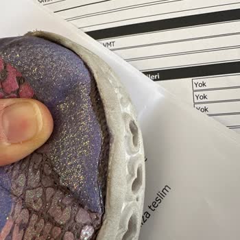 Metro Grossmarket Metro Marketin Sattığı Skechers Ürünle İlgili Sorumluluk Almaması