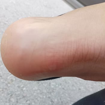 DGN - Doğan Çanta Dgn Gazimuhtar Gaziantep Pişmanlığı