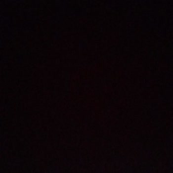 Kızımın Ayağına Batan Etiket İğnesi Ve Mağaza İlgisizliği #Koton