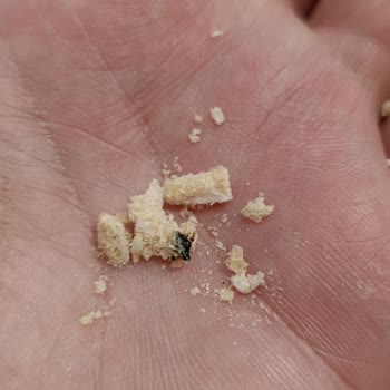 Eti Gıda Ürününüzden Yine Yabancı Cisim Çıktı!