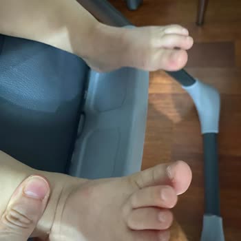 Vicco Ayakkabı Bebeğimin Ayağını Mahvetti