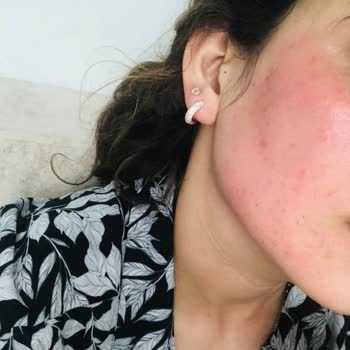 New Well Güneş Kremi Şikayet