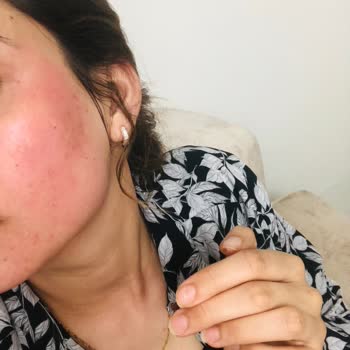 New Well Güneş Kremi Şikayet