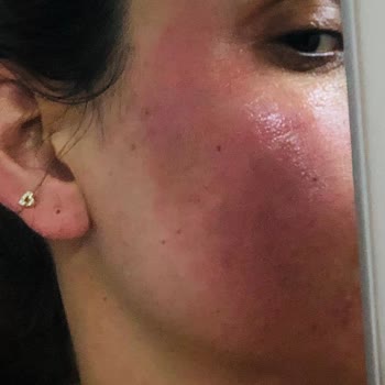 New Well Güneş Kremi Şikayet