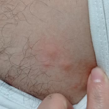 Enza Home Tahta Kurusu Mağduru
