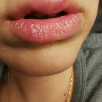 Nivea Dudak Kremi Dudaklarımı Mahvetti