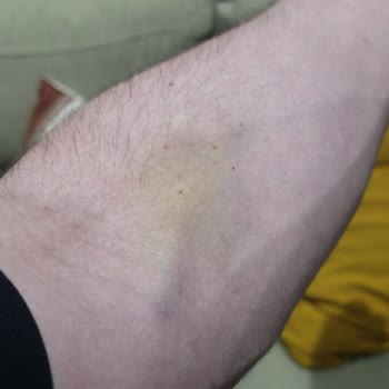 Pendik Devlet Hastanesi Kan Alma Bölümündeki Hemşireler Çok İlgisiz.