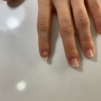 Yonca Güzellik Merkezi (Hatay) Küflü Tırnak Sonuçlu Özensiz Uygulama