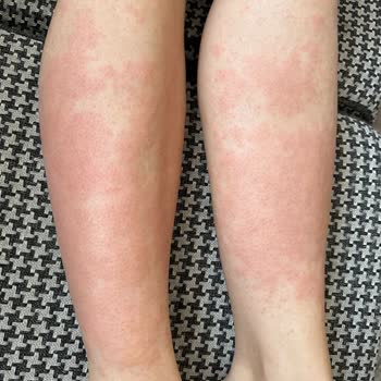 Glam Life Güzellik & Cilt Bakım Merkezi Nata Vega Şubesi İş Bilmeyenler