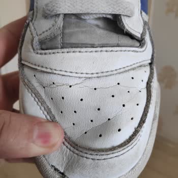 Adidas Spor Ayakkabı Çatlaması