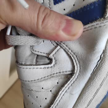 Adidas Spor Ayakkabı Çatlaması