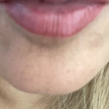 Merve Dönmez Timeless Beauty Hatalı Dudak Renklendirme