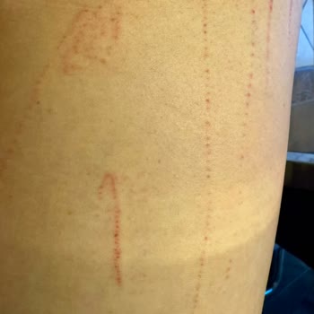 Sibel Sucularlı Beauty Studio Lazer (Vücut Çizme Kanatma Seansı)