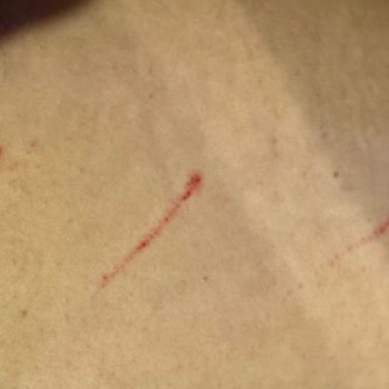 Sibel Sucularlı Beauty Studio Lazer (Vücut Çizme Kanatma Seansı)