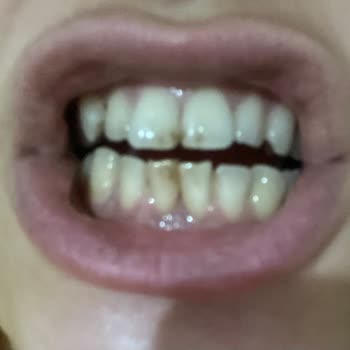 Sensodyne Hiç Memnun Kalmadım