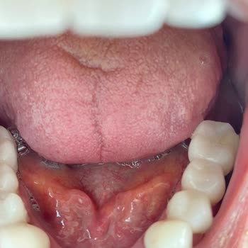 Cadde Dental Sağlık Hizmeti Adı Altında Mağduriyet
