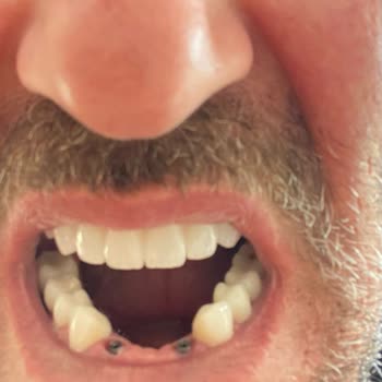 Cadde Dental Sağlık Hizmeti Adı Altında Mağduriyet