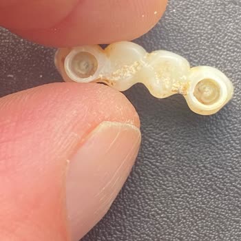 Cadde Dental Sağlık Hizmeti Adı Altında Mağduriyet