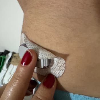 Medsalus Dexcom G6 Sensör Bantları Tutmaz Oldu
