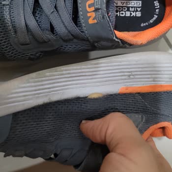 Skechers Ayakkabı Garanti Dışında Bırakıldı