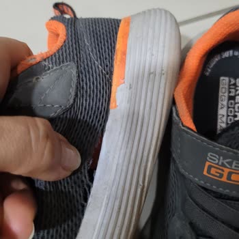 Skechers Ayakkabı Garanti Dışında Bırakıldı