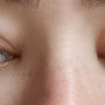 Elensilia CPP %80 Fransız Kolajeni Gözlerimde Ödem Yaptı