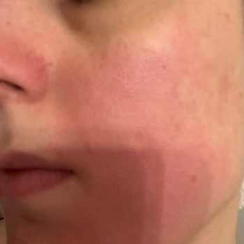 Uni Baby Bebek Şampuanı Yüzümü Mahvetti