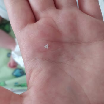 Sleepy2 Numara Bezin İçinde Sert Cisim Çıktı