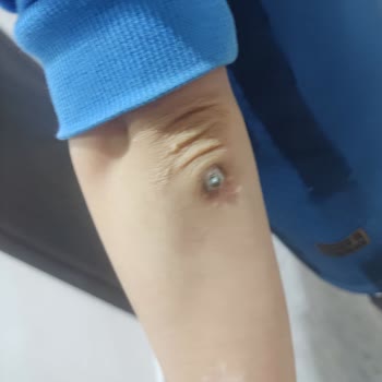 Prof. Dr. Cemil Taşçıoğlu Şehir Hastanesi Ortopedi İlgisizliği Artık İsyan Ettirdi