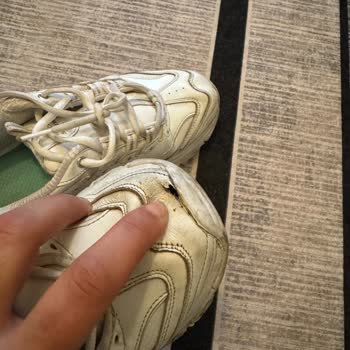 Skechers İnsanları Mağdur Ediyor😔