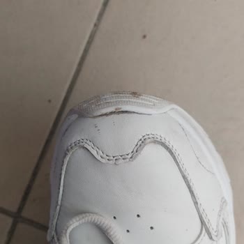 Skechers Marka Ayakkabının 2 Günde Önünün Açılması