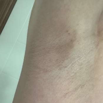 Rexona Clinical Protection. Koltuk Kararma Yaptı