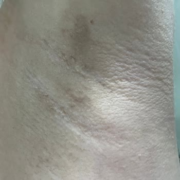 Rexona Clinical Protection. Koltuk Kararma Yaptı