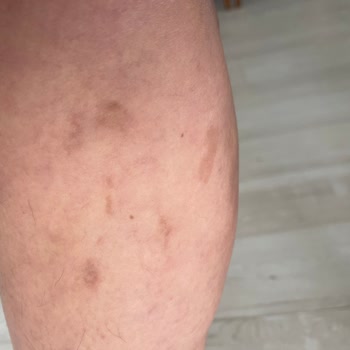 Climed Tedavi Merkezi Climed Varis Şikayeti